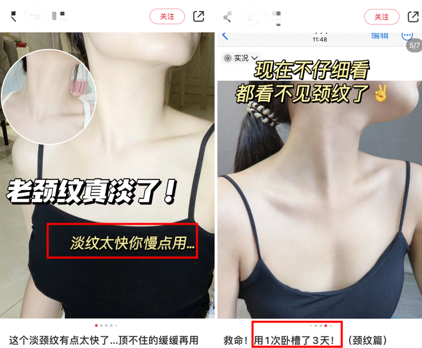 颈纹霜效果对比_颈部护理方法_颈肩腰腿疼培训
