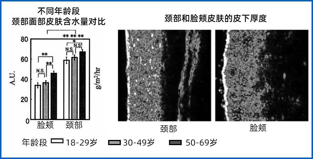 颈纹霜效果对比_颈部护理方法_颈肩腰腿疼培训