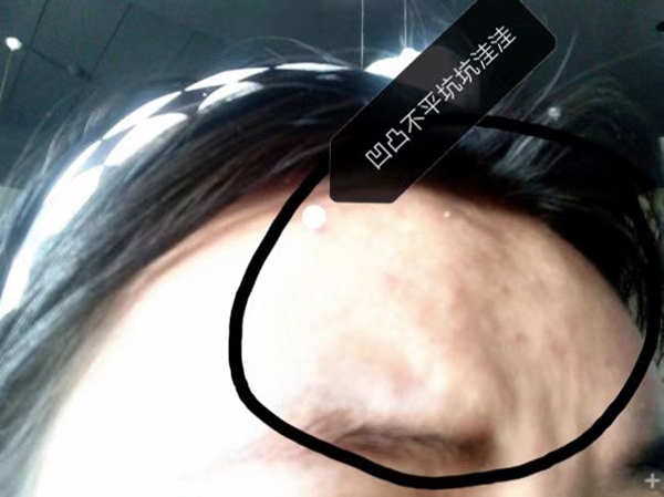_线下加盟贷款机构_ 集美美容医院 美容贷 欺诈行为 